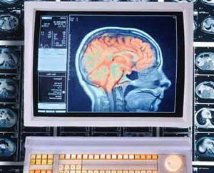 بررسی مناطق مغزی درگیر در ولع مصرف معتادان تزریقی هرویین به وسیله تصویربرداری مغزی عملکردی