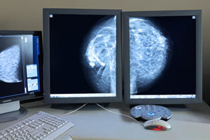 ماموگرافی به چه دردی می خورد