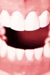 بررسی رابطه بین تماسهای زودرس دندانی و ضایعات فاقد پوسیدگی طوق دندان