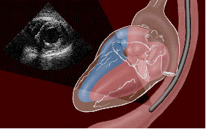 اکوکاردیوگرافی را قورت بده