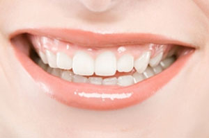 دست یابی به نتیجۀ فوری برای سفید کردن دندان ها