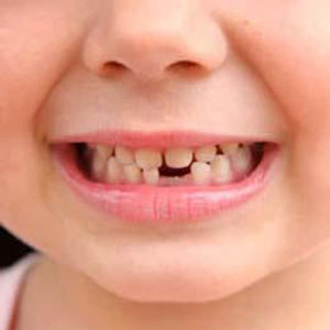 دندان هایی که سالم رشد نمی کنند