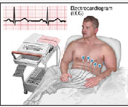 روش های تولید سیگنال الکتروکاردیوگرام ECG