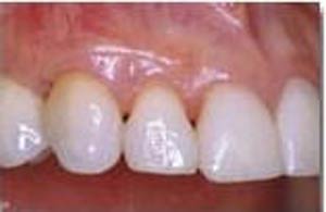 بافت نگهدارنده دندان چیست
