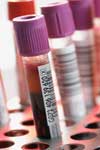 فراوانی آنتی بادی های ضد سیتومگالوویروس در اهداکنندگان خون ارومیه