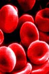 بررسی تاثیر الگوی مراقبت پی گیر بر میزان قند و هموگلو بین گلیکوزیله خون در بیماران دیابتی ارومیه