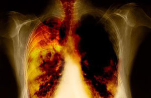 Lungs extraordinary things you are doing