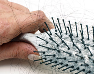 علل ریزش مو خانم ها چیست