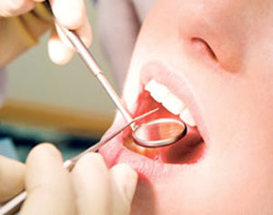 علل زرد شدن دندان ها و راه پیشگیری
