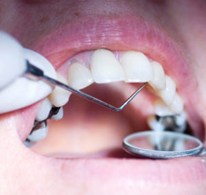 پیش شرط های ملاقات با دندانپزشک