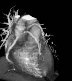 راهیابی به اعماق قلب معرفی روش کاتتر آنژیوگرافی