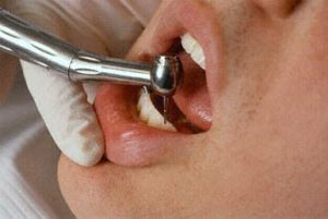 چند نکته درباره آنچه دندان پزشکان با آن سروکار دارند