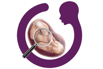 تشخیص بیماری ها قبل از تولد