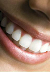 بررسی وضعیت سلامت دندان ها و انساج پریودنتال افراد ساکن در مناطق دارای پرتوزایی طبیعی بالا در مقایسه با منطقه کنترل در شهرستان رامسر سال ۸۳ ۱۳۸۲