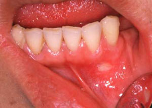 سلامت دهان و دندان نیازمند نگاهی نو