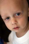 تعیین عوامل موثر بر بقا در اطفال مبتلا به نوروبلاستوما