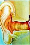 تغییرات هدایت استخوانی پس از بازسازی زنجیره استخوانچه ای گوش میانی
