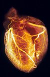 انتخاب فیلتر در تصویربرداری از خونرسانی عضله قلب با ۹۹mTc MIBI بروش SPECT
