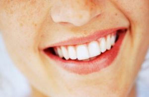 سفید کردن دندان ها, چه خطراتی دارد