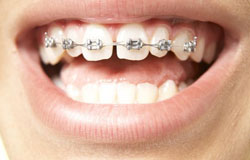این درمان دندانپزشکی سودمند است