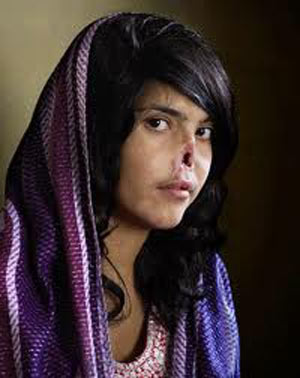 طالبان, عایشه و جراحی زیبایی