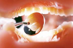 هفت خوان درمان ریشه دندان