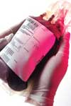 شیوع عفونت های منتقله از طریق خون در اهداکنندگان رشت