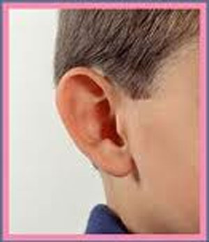 جراحی زیبایی گوش اتوپلاستی