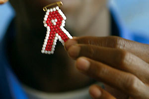 تاریخچه بیماری ایدز