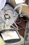 شیوع عفونت های منتقله از طریق خون در اهداکنندگان رشت