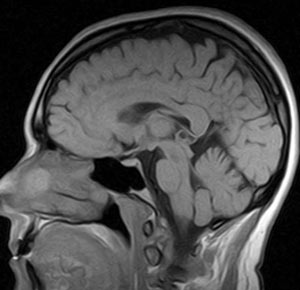 مزایا و معایب MRI در یک روش تشخیصی