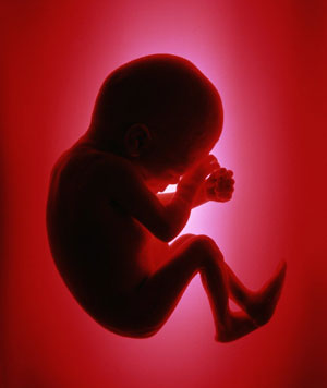 آسیب های عصبی در مشاهده نخستین تصویر جنین