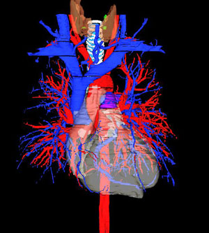 شریانهای کرونری دستگاه گردش خون