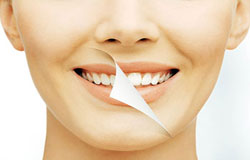 بهترین روش برای سفید کردن دندان