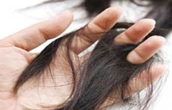 خزان موها و راهکارهای درمانی