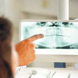 رادیوگرافی دندان به چه درد می خورد