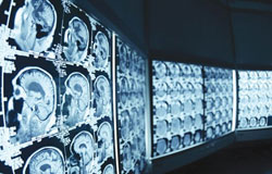رادیولوژی و دنیایی از خدمات تشخیصی
