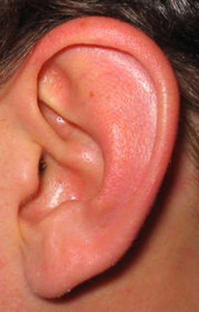 ناشنوایی و اختلال در شنوایی