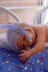 بررسی شیوع علل دیسترس تنفسی در نوزادان بستری در NICU و سیر بیماری در آنان