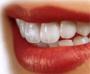 چگونه دندانهای زیبا داشته باشیم