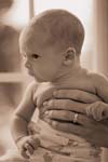 بررسی فراوانی هیپوتیروئیدی در نوزادان با هیپربیلی روبینمی غیرمستقیم