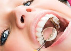 سوالات رایج در دندانپزشکی