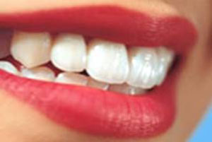 دستور العمل های خانگی برای سفیدی دندان