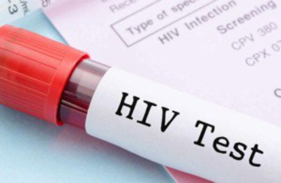 تشخیص سریع ابتلا به ایدز و هپاتیت