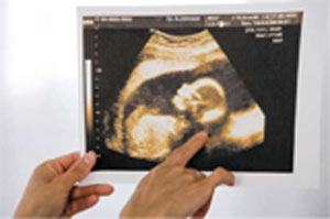 یک بارداری چند سونوگرافی می‌خواهد؟