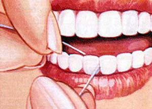 وسیله‌ های ‌جایگزین‌ نخ ‌دندان
