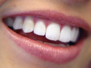 دندان‌ها آینه تمام نمای بدن هستند
