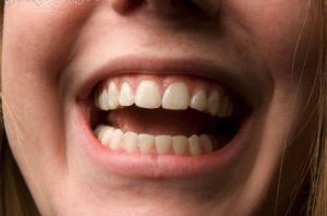 اقدامات بهداشتی و پیشگیری از مشکلات دهانی دندانی