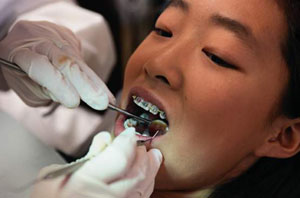 پُر کردن دندان و مسمومیت با جیوه؟