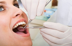 چه دندانی باید عصب کشی شود؟